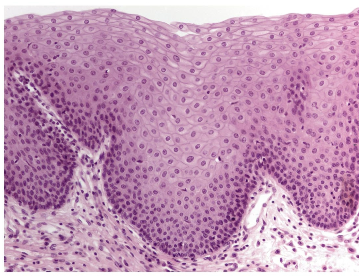 <p>what tissue is this</p>