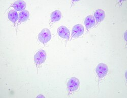 <p>Kite shaped trophozoite? Falling leaf motility? Duodenal aspirate specimen?</p>