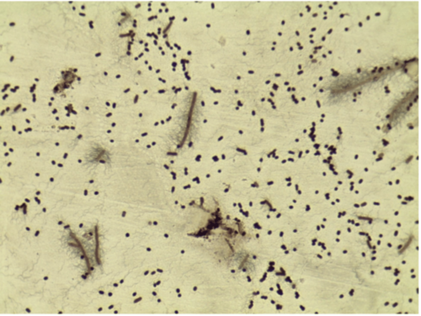 <p>EX: salmonella, proteus mirabilis</p>