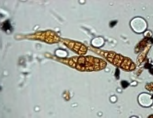 <p>Type of mold? </p>