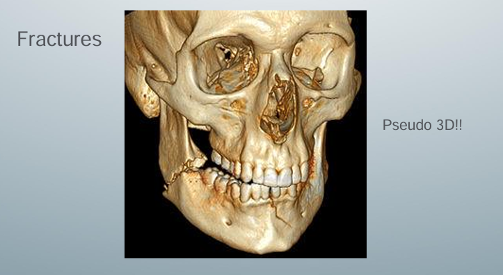 <p>-might be helpful to visualize fractures prior to the surgery</p>