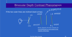 <p>If the outer two lines are inclined, what is this disparity stimulus for?</p>