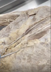 <p>Name the structure</p><p>- just off of latissimus dorsi</p>