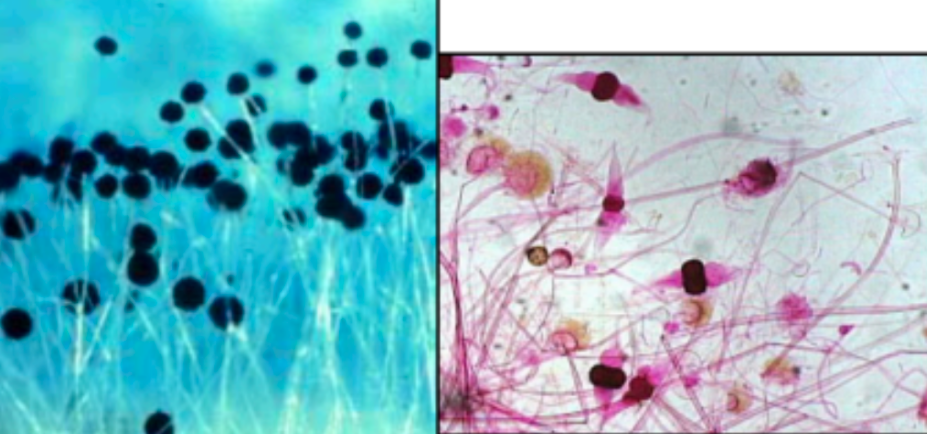 <p><span style="background-color: transparent;">What Domain, Supergroup, Kingdom, and Phylum do these organisms belong to?</span></p>