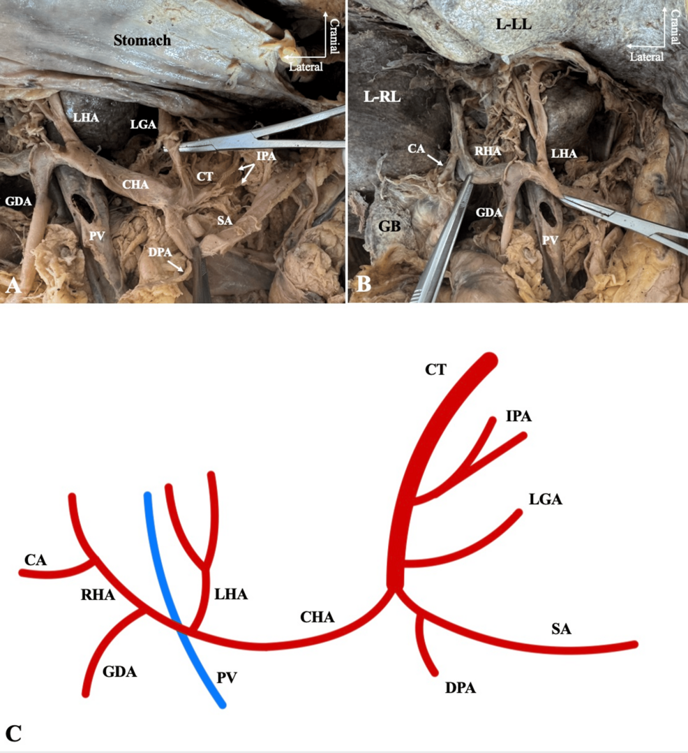 <p>branch that goes from hepatic artery proper to the left </p><ul><li><p>structure</p></li></ul><p></p>