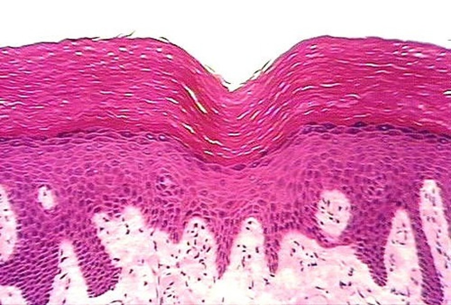 <p>Keratinized stratified squamous</p>