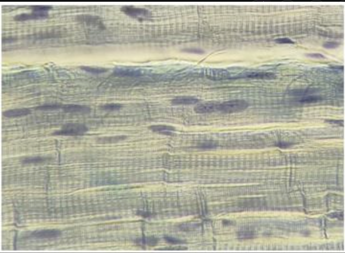 <p>skeletal muscle</p>
