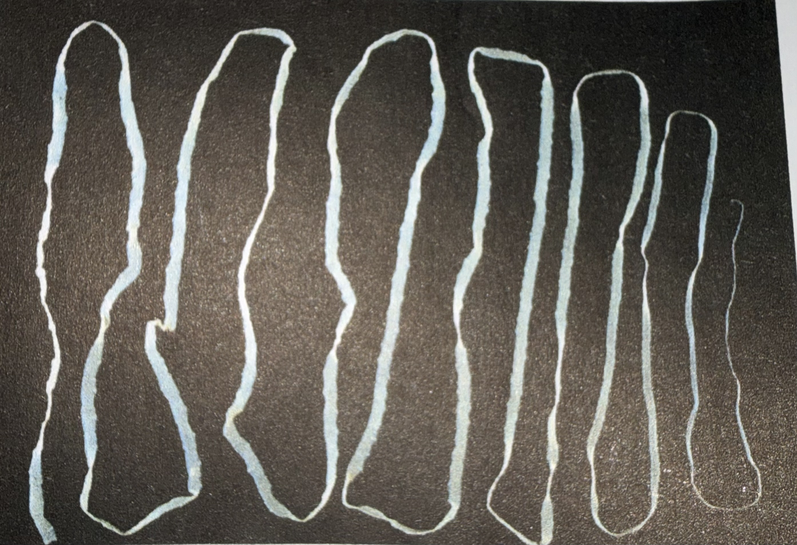 <p>*What type of helminth is this?</p>