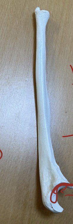 <p>Name and Type of this bone</p>