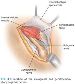 <p>iliohypogastric</p>