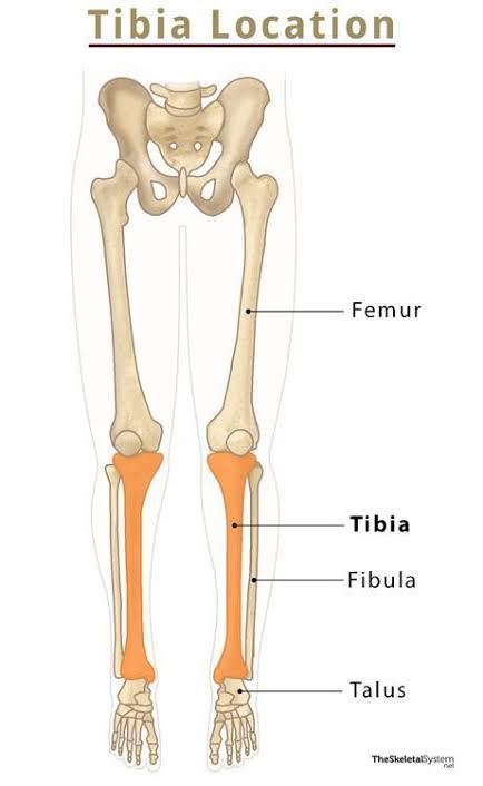 <p>Thicker medial shin bone; weight-bearing.</p>