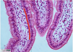 <p>Identify the structure in red (in the tagged structure list)</p>