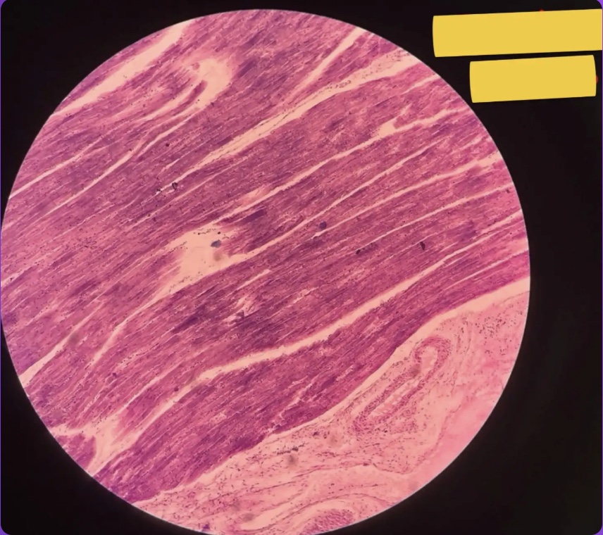 <p>What does the yellow box represent?</p>