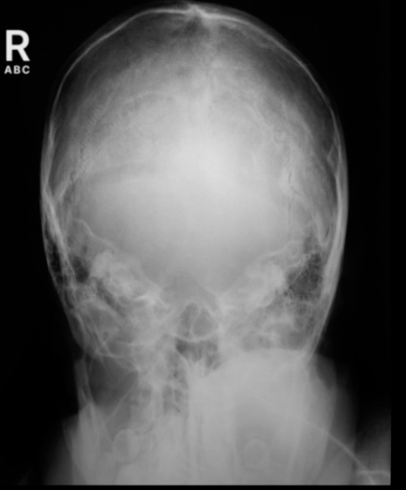 <p>AP Axial Towne’s demonstrates:</p>