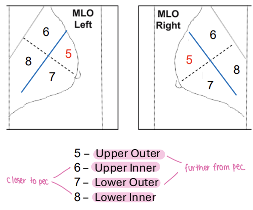 <p>5: upper outer</p><p>6: upper inner </p><p>7: lower outer </p><p>8: lower inner </p>