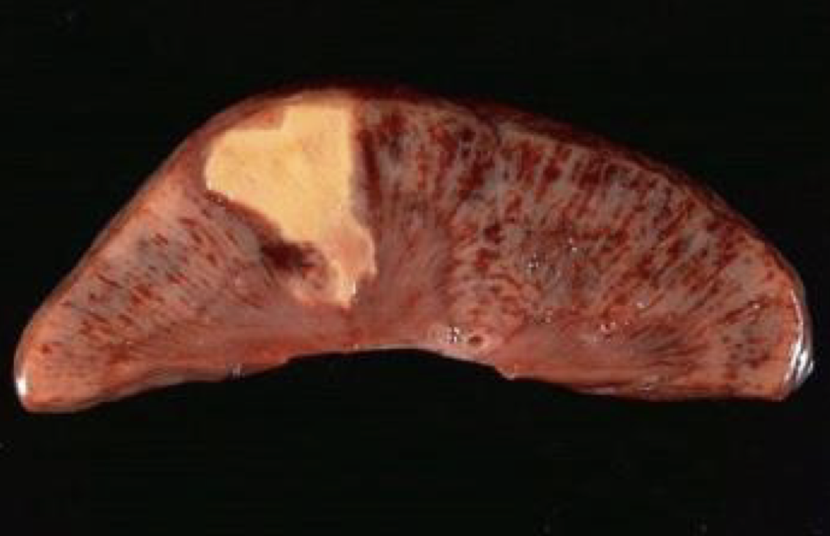 <p>diagnose</p>