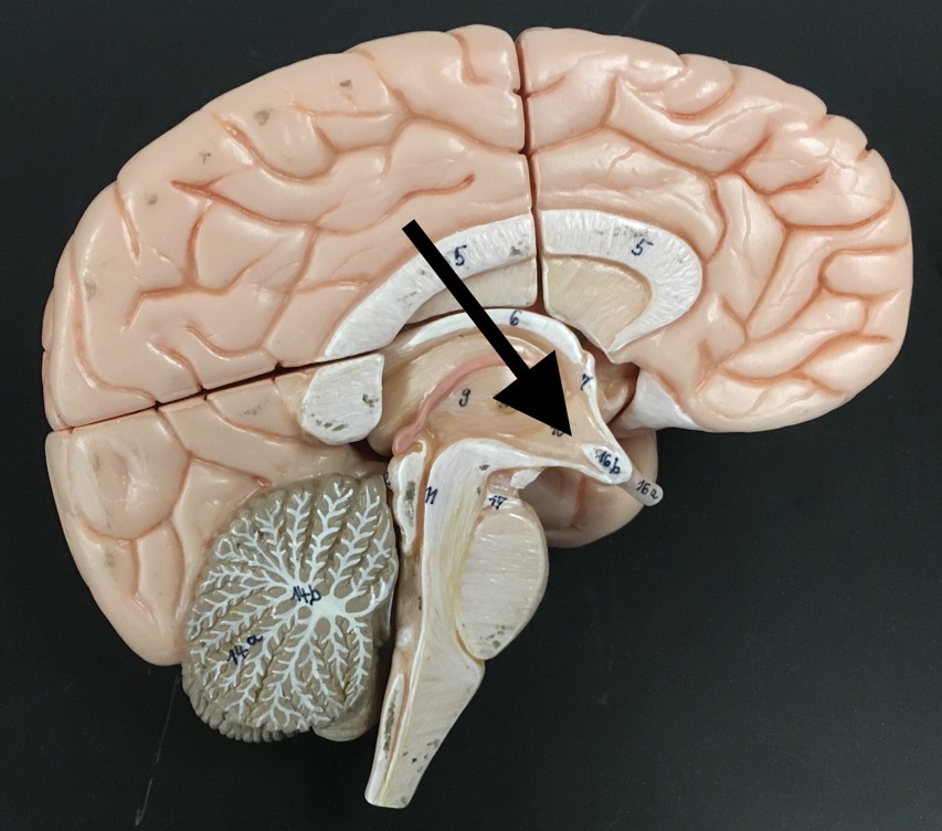 <p>What is the arrow pointing to?</p>