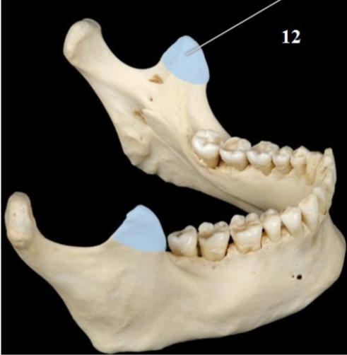 <p>Name This Structure and the Muscle that Inserts</p>
