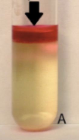 <p>This indole test is _______. </p>