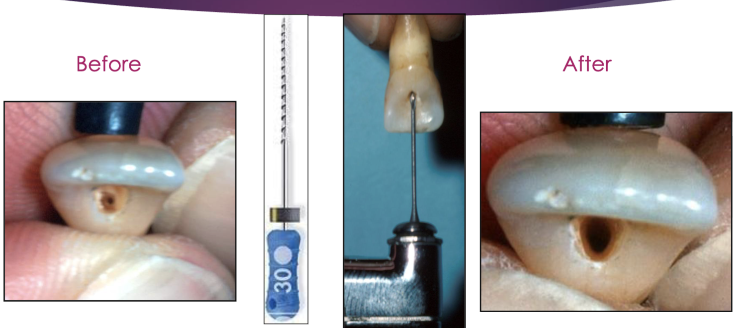 <p>gates glidden #2/3/4 and hedstrom file </p>