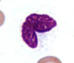 <p>name the leukocyte</p>