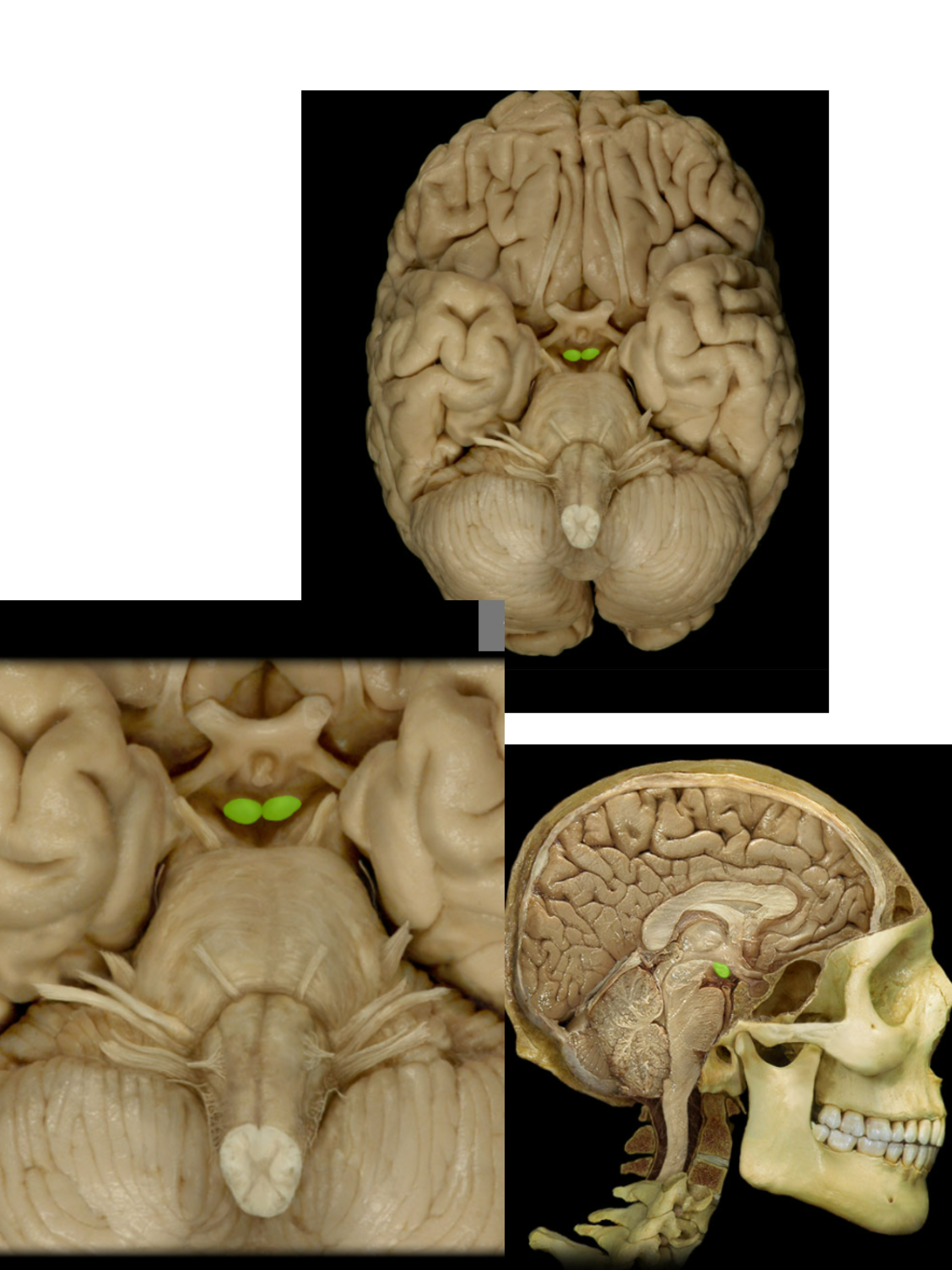 <p><span>Mammillary body</span></p>