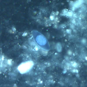 <p>UV</p>