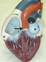 <p>Identify this blood vessel starting here (be specific).</p>