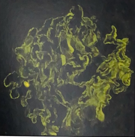 <p>1. Identify the fixative for procedure shown. </p><p>2. Identify the tissue</p>