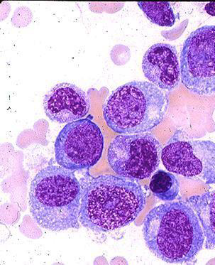 <p>The white circular area outside of the nucleus is what organelle</p>