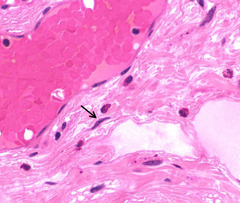 <p>What is indicated by the arrow?</p>