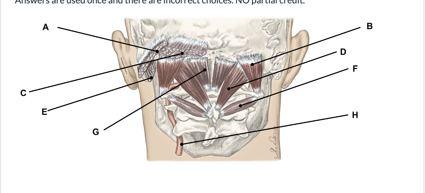 <p><span>Match the appropriate term with the landmark or structure (A-H) identified in the picture below. Answers are used once and there are incorrect choices. NO partial credit.</span></p>