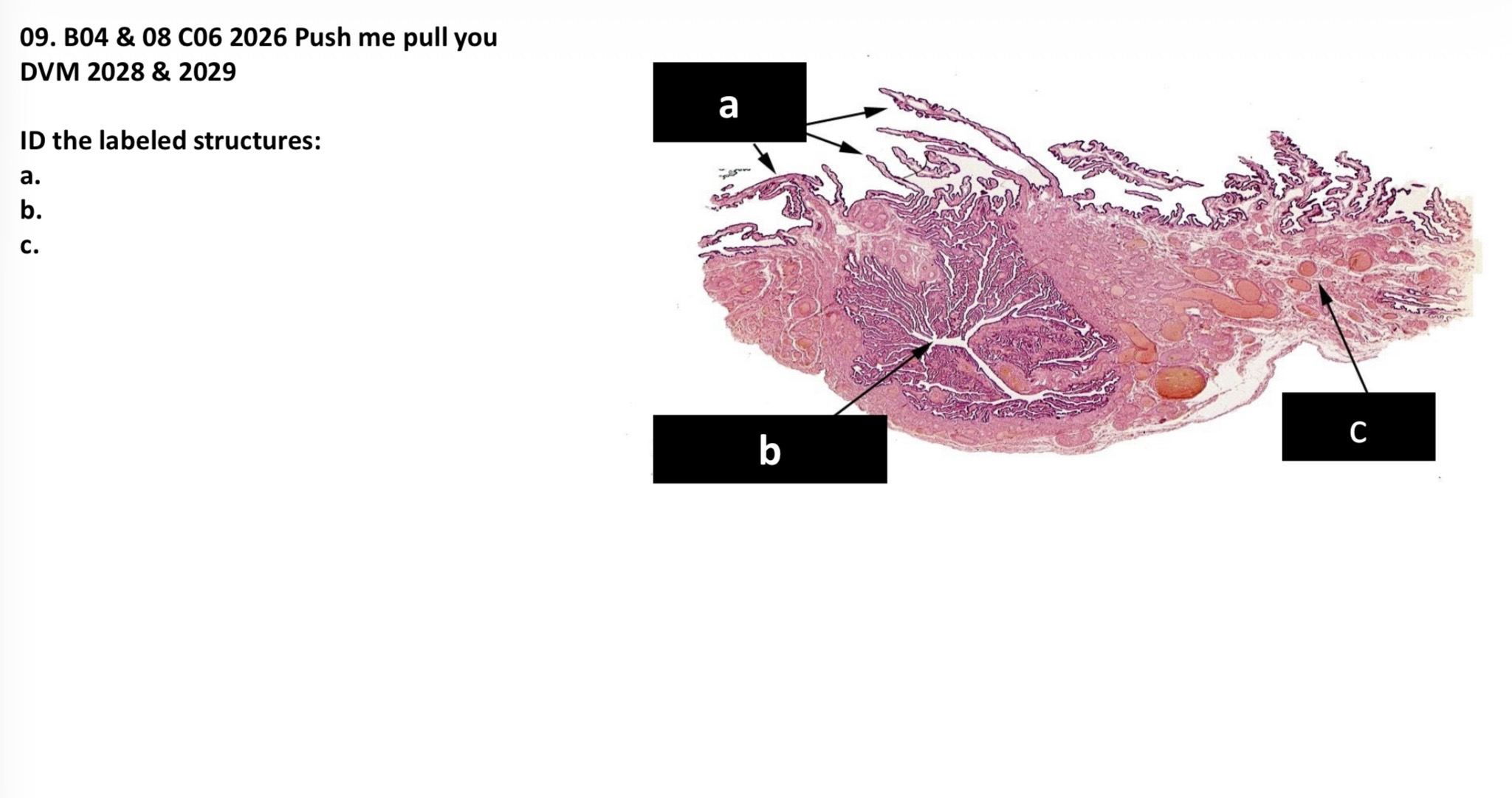 <p>A. Fimbria of the uterine tube </p><p>B. Infundibulum of the uterine tube </p><p>C. Mesoalpinx</p>