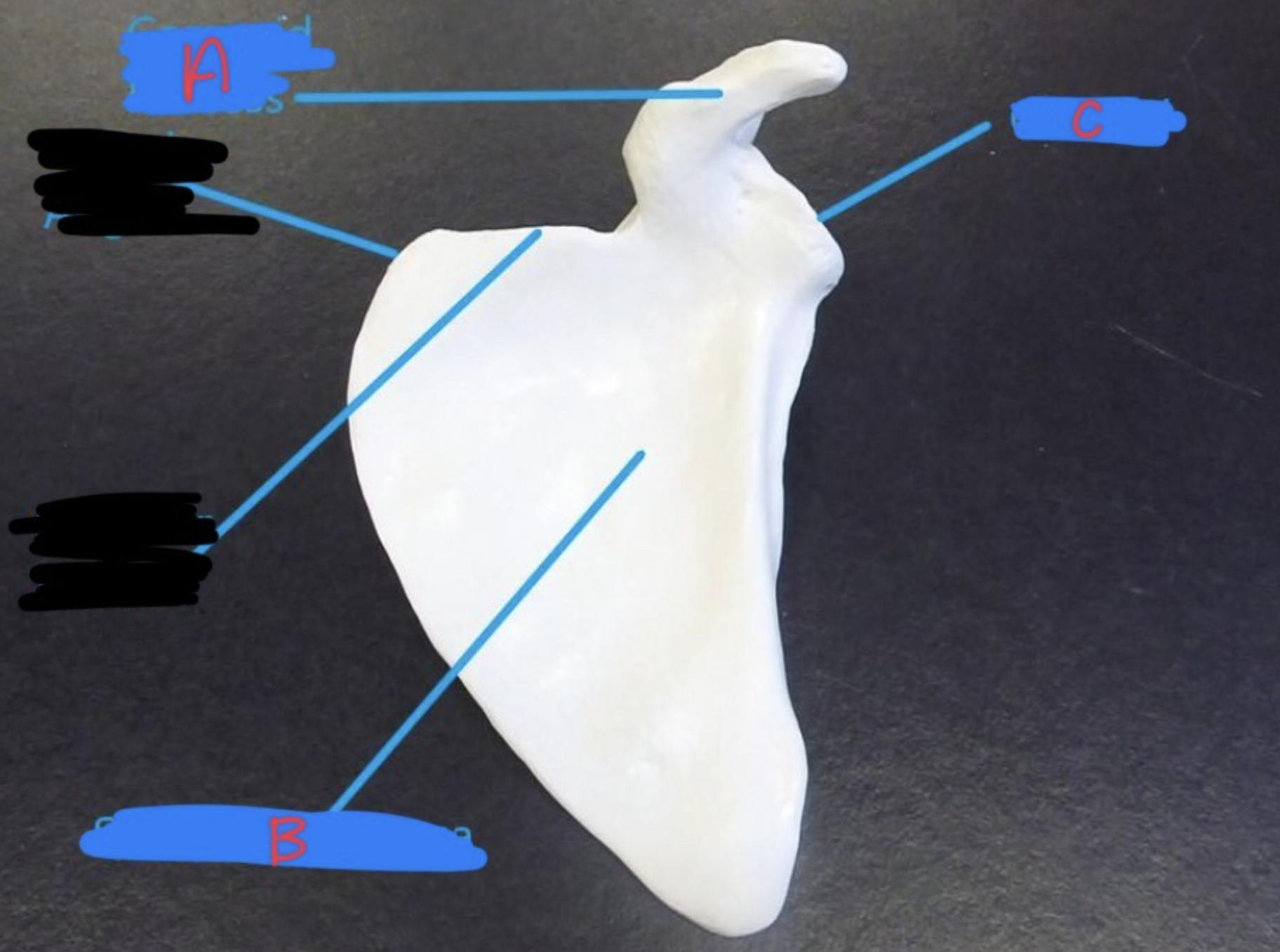 <p>name a-d on the ANTERIOR side of a SCAPULA</p>