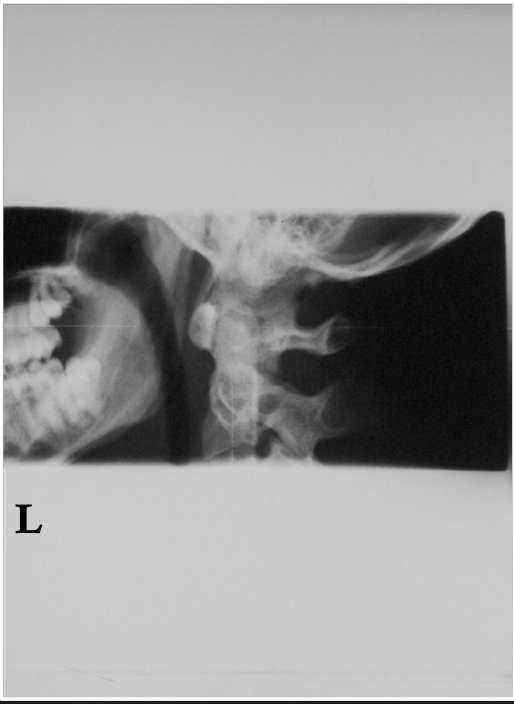 <p>Is this film of diagnostic quality (Lateral Cervical) </p>