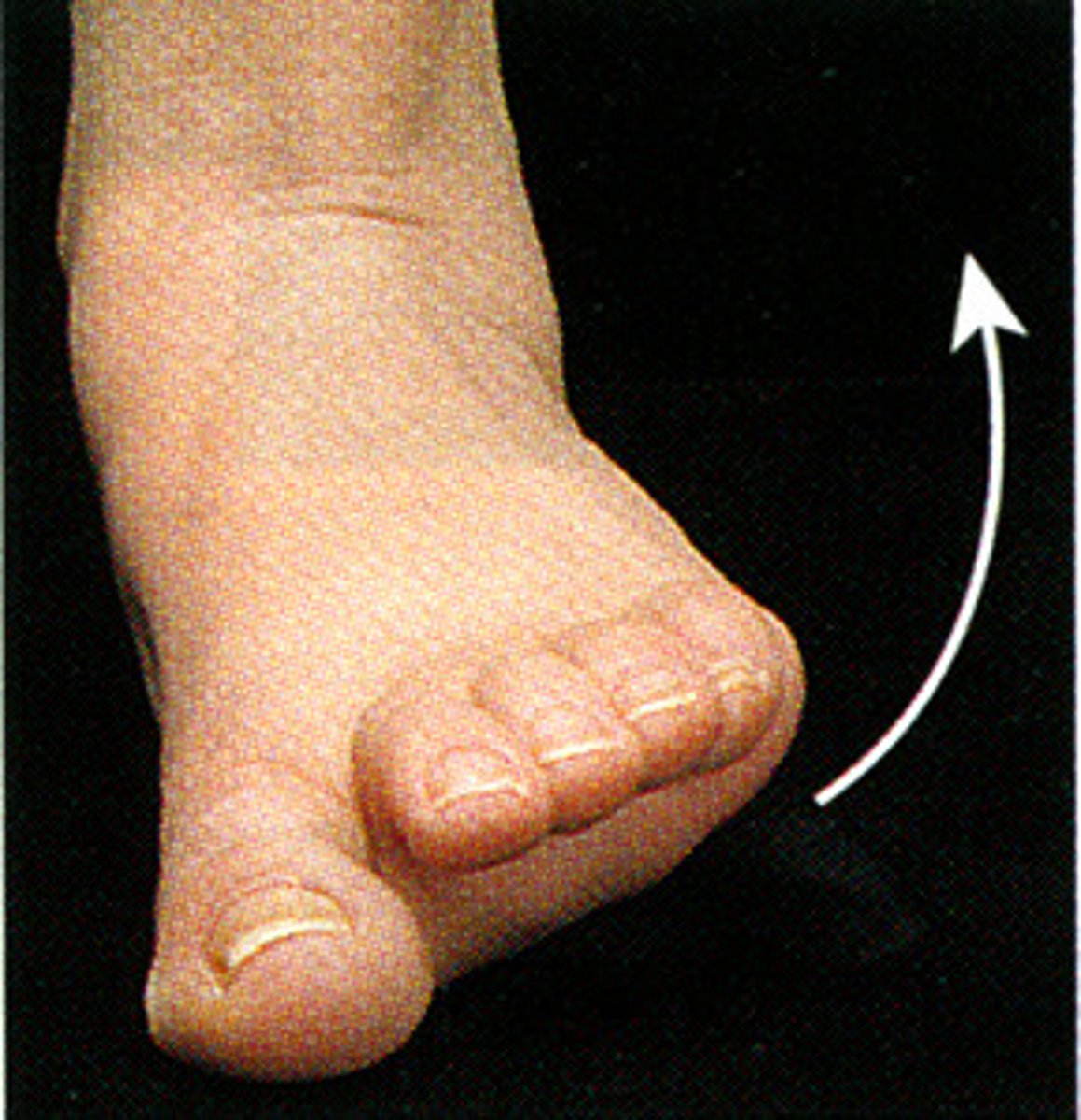 <p>rotation of sole of foot away from midline</p>