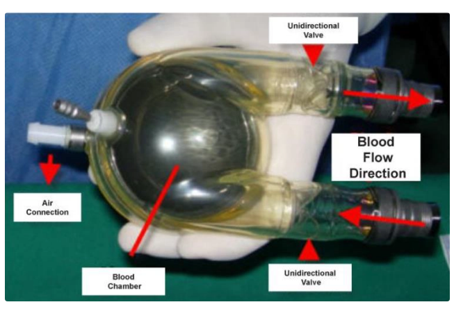 <ul><li><p>pneumatic, pulsatile flow pump</p></li><li><p>long term full cardiac support</p></li><li><p>high thombotic and bleeding risk</p><ul><li><p>strong anticoagulation is needed because of large surface and mechanical valves</p></li></ul></li><li><p>LVAD, RVAD, BIVAD setting is available</p></li><li><p>can use for kids</p></li></ul><p></p>