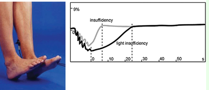 <p>PPG transducer emits infrared light and senses signal reflected back from blood </p><ul><li><p>baseline recorded while limb is relaxed</p></li><li><p>next tracing recorded with flexion/relaxation of foot </p><ul><li><p>tracing falls to bottom </p></li></ul></li><li><p>returns back to baseline during<strong> venous return time (VRT) </strong></p></li></ul><p></p>