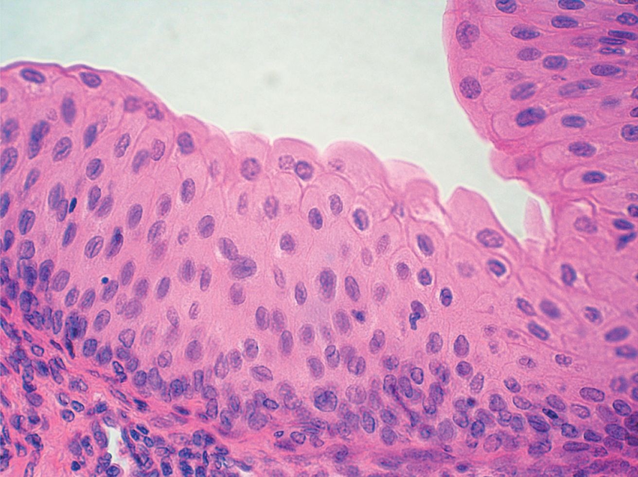 <p><span>Transitional Epithelium / <strong>Urothelium</strong></span></p>