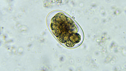 <p>Necator americanus Eggs</p>