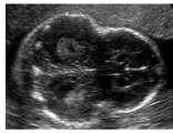 <p>What image is this?</p>