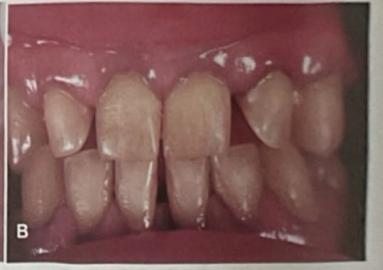 <p>CHẨN ĐOÁN?</p>