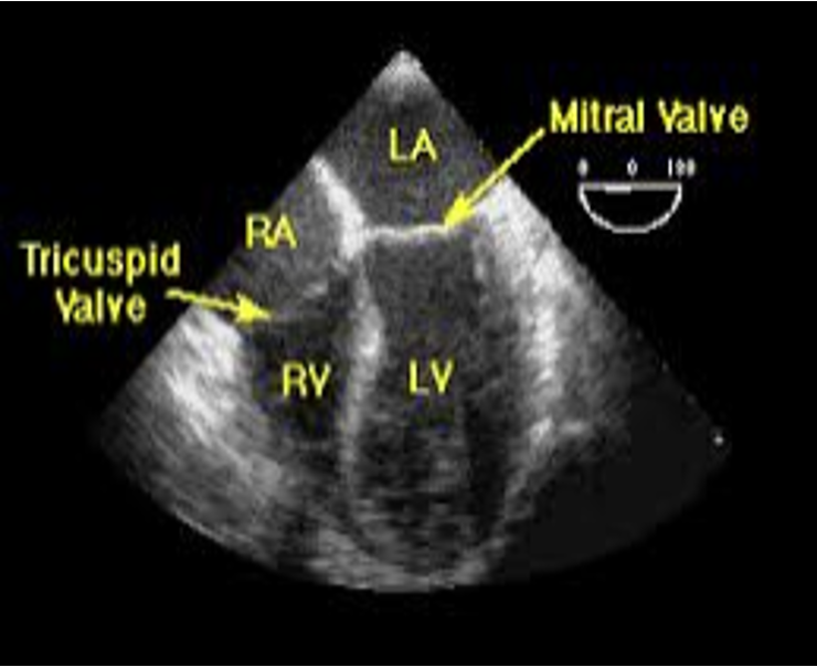 <ul><li><p>EKG</p></li><li><p>Echocardiography</p></li><li><p>Weight checks</p></li><li><p>Chest X-Ray</p></li><li><p>Labs: Brain Natriuretic Peptide (BNP), CBC, CMP, TSH, cardiac enzymes</p></li></ul><p></p>