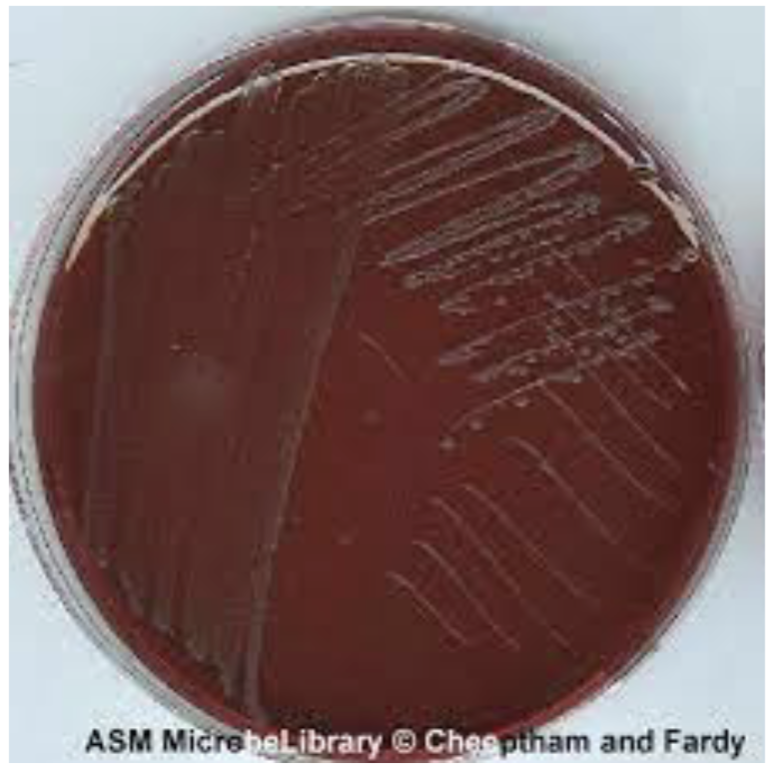 <p>Eosin Methylene Blue emb- <strong><u>Salmonella</u></strong></p>