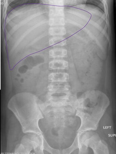 <p>What anatomy is outlined in this image?</p>