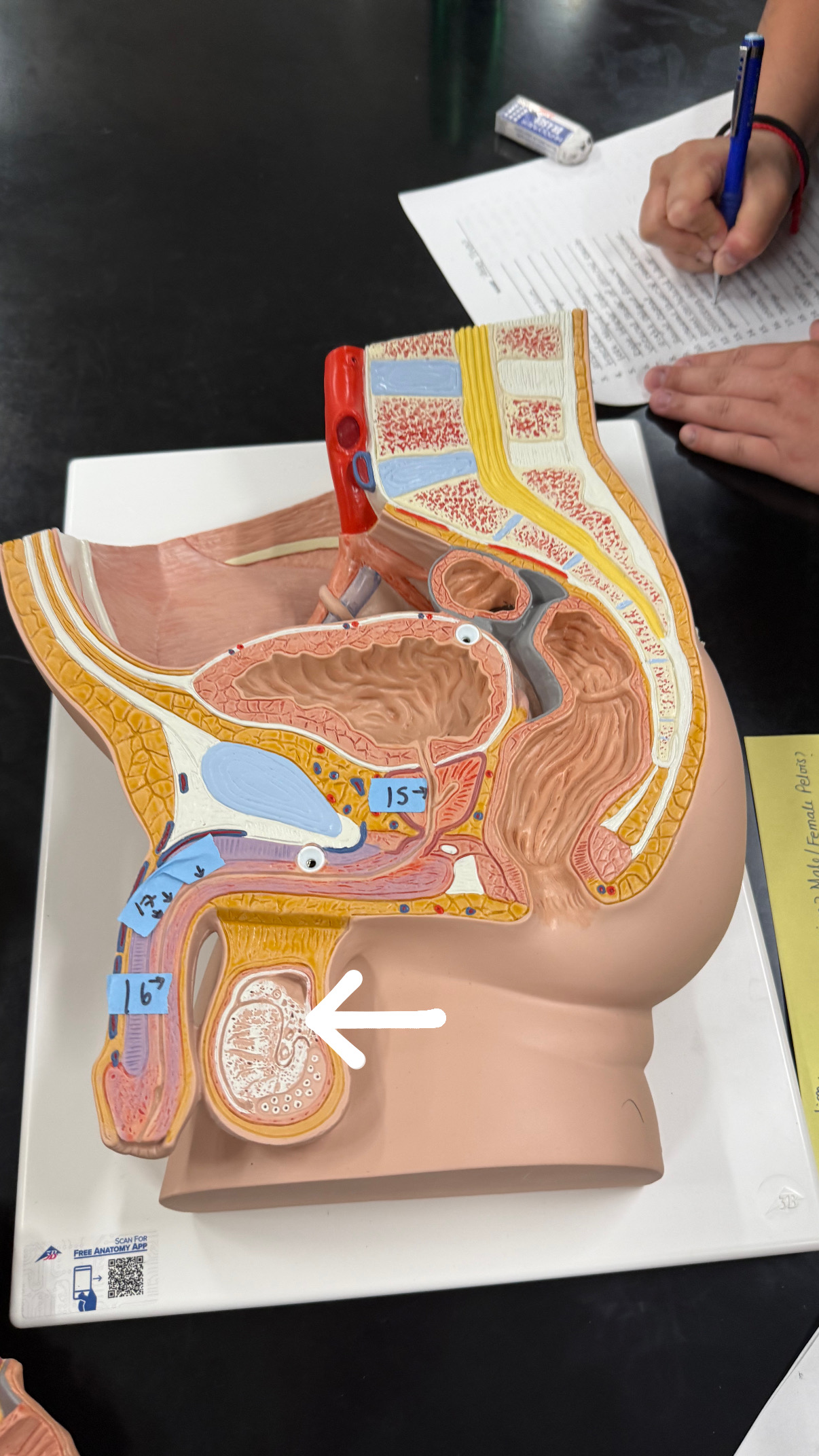 <p>lining the top og the balls, where sperm matures</p>