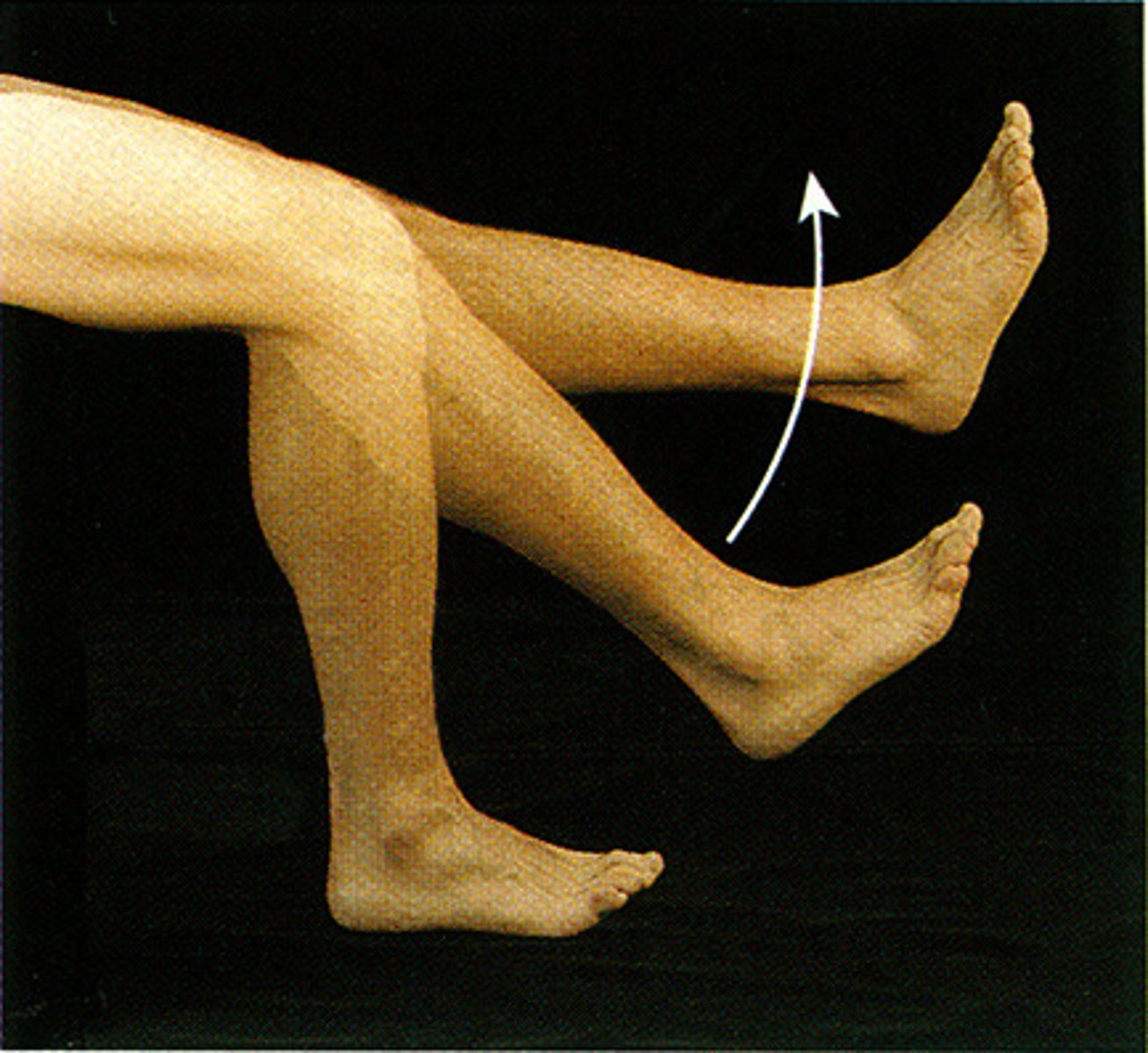 <p>Increasing the angle between bones, usually in the sagittal plane</p><p>Example: Straightening the fingers after making a fist</p>