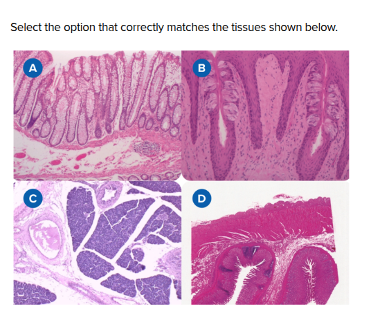 <p>What is A, B, C, and D?</p>