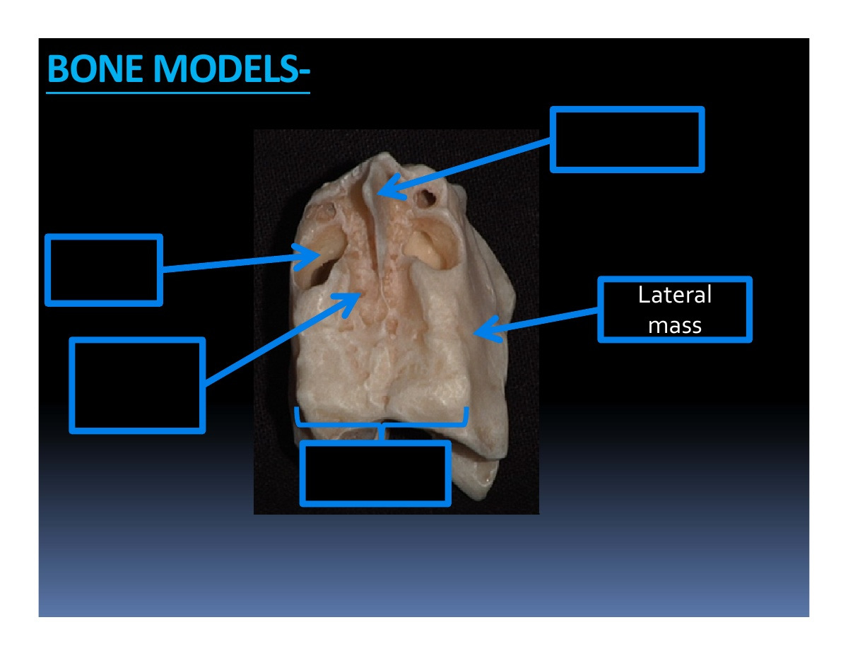 Lateral mass