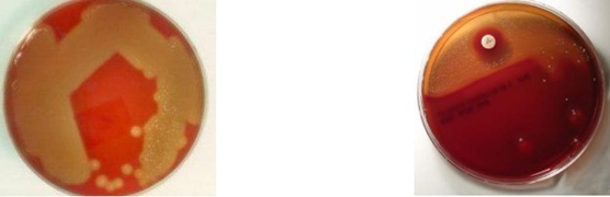 <p>Which microorganism causes <strong>complete beta hemolysis</strong> on <strong>blood agar plates</strong> and is <strong>sensitive to bacitracin (A disk)</strong>?</p>